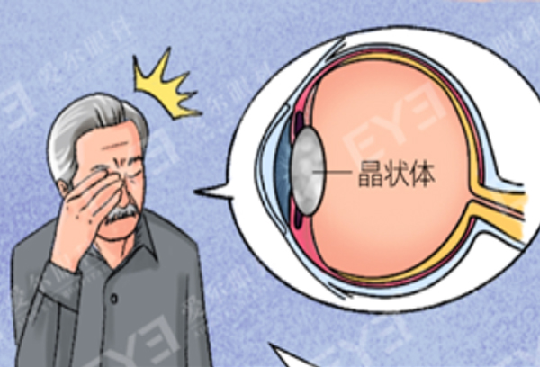 治疗白内障，一定要动刀吗？